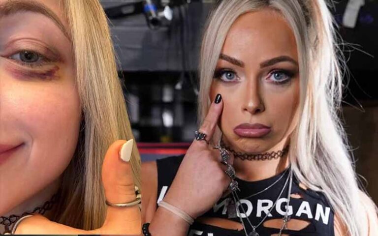 Liv Morgan Sports activities Black Eye After Competing in Battle Royal on RAW