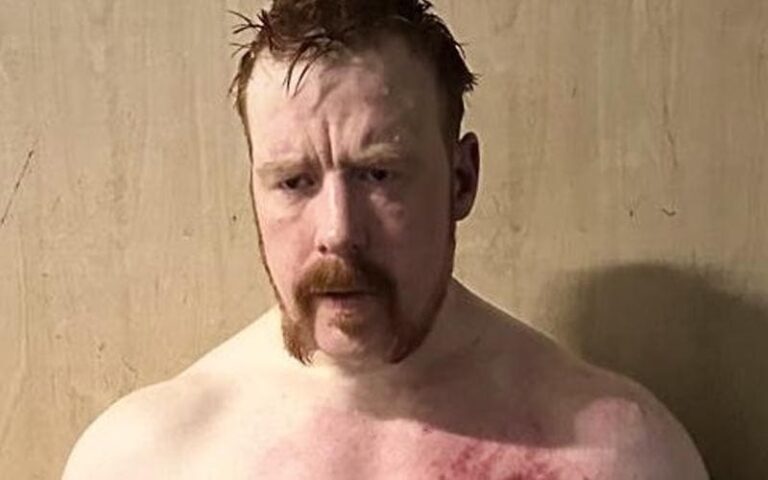 Sheamus Reveals Off Battle Scars Following Intense Bout With Ludwig Kaiser on 6/3 WWE RAW