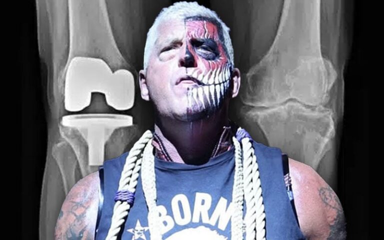 Dustin Rhodes Undergoes Double Knee Substitute Surgical procedure