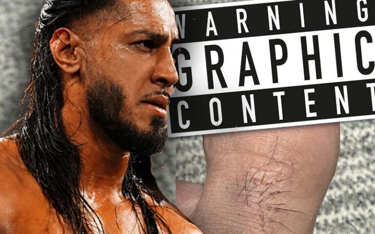 Mustafa Ali Reveals Off Bloody Toe Harm After TNA Genesis